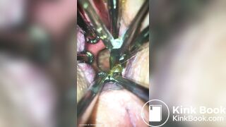 Anal play - video 30