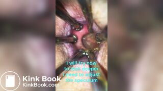 Anal play - video 30