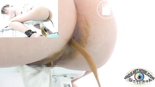 The enema restraint 2