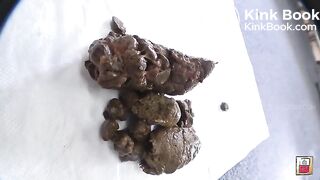 Hard constipated poop - video 2