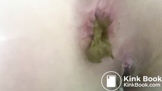 Hot Gaping Hole Knobbly Turd Close Up