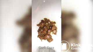 Random Poop Compilation Collective.. - video 28