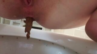 Random Poop Compilation Collective.. - video 14