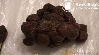 Random Poop Compilation Collective.. - video 34