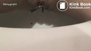 Angie has diarrhea in toilet