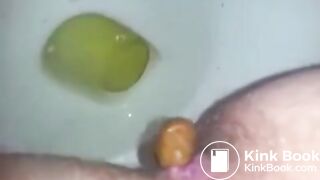 Diarrhea - video 54