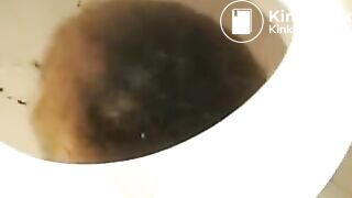 Simone and Alice have Diarrhea