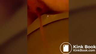 watery diarrhea pooping