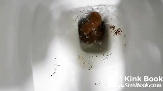 Scat755