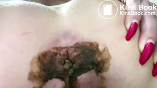 Gigantic, Quick Shit