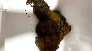 Gigantic, Quick Shit