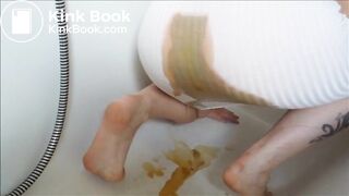 White skirt diarrhea