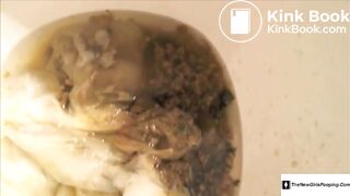 colonoscopy - video 3