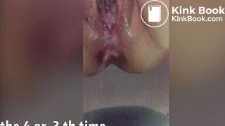 I have endless diarrhea to piss out