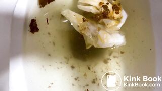 Woman Shits Turd as Big as Her Forearm