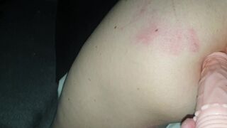 accident dildo big ass