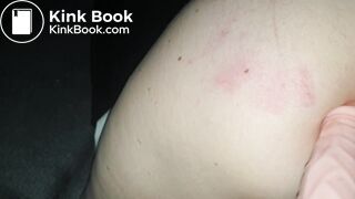 accident dildo big ass