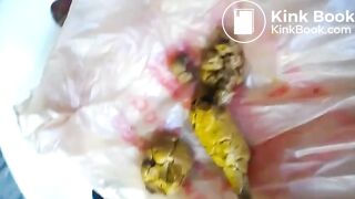 Girl poops on a plastic bag
