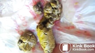 Girl poops on a plastic bag