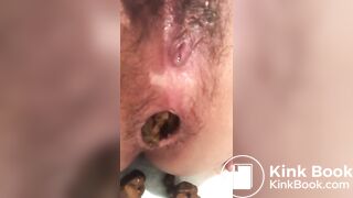 Hot Slow Knobbly Poop