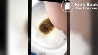 girl liqudid diarrhea