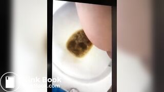 girl liqudid diarrhea