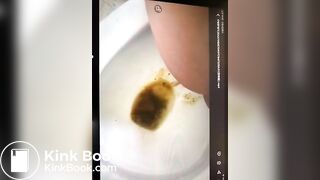 girl liqudid diarrhea