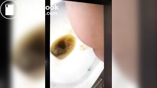 girl liqudid diarrhea