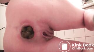 Woman pushes out huge poop