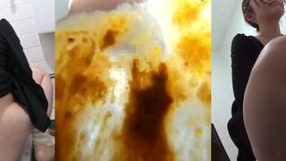 Top Ten Shits that cured my depression.