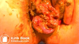 Shit-Covered Silently Barking Prolapsed Anus