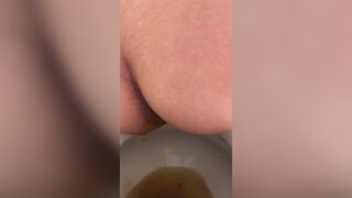 Diarrhea Shit in Toilet