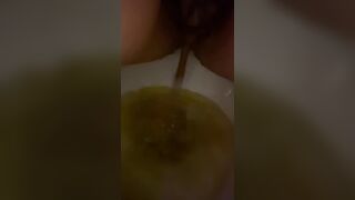 Diarrhea Toilet Shitting