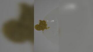 Korean girl diarrhea 5 - video 2