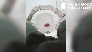 拉肚子了2