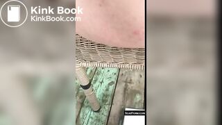 Close up scat, little prolapse