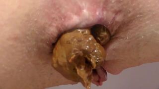 closeup6