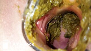 Solo Scat Sluts 20: Pussy Shit Stuffing (Part 2 of 4)