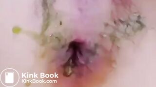 korean girl scat anal candy