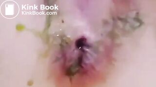 korean girl scat anal candy