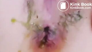 korean girl scat anal candy