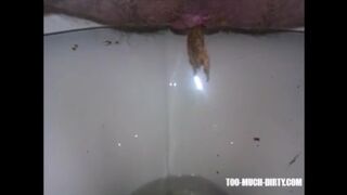 Hairy granny shitting closeup