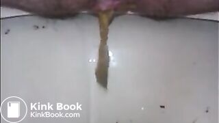 Hairy granny shitting closeup