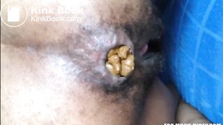 Hairy girl shitting an hard turd