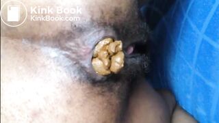 Hairy girl shitting an hard turd