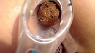 shitting in speculum
