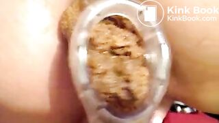 shitting in speculum