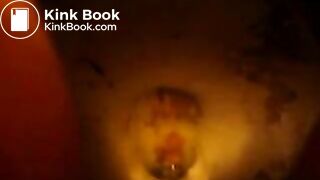 Explosive diarrhea the next morning