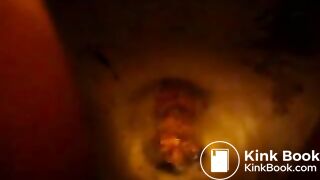 Explosive diarrhea the next morning