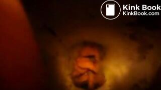 Explosive diarrhea the next morning